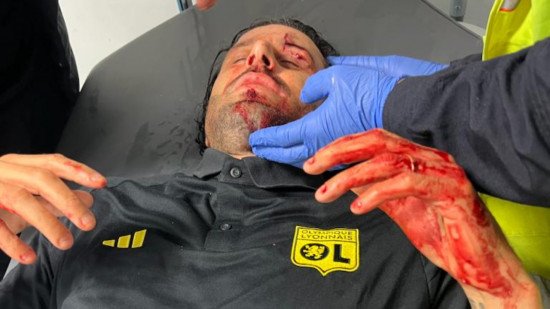 Bus caillassé, Fabio Grosso blessé : OM-OL ne se jouera pas ! Bus caillassé, Fabio Grosso blessé : OM-OL ne se jouera pas !