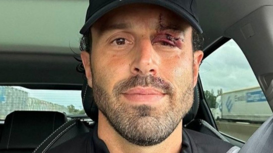 Olympico : 30 jours d'ITT pour Fabio Grosso, aucune interpellation pour le caillassage du bus de l'OL Olympico : 30 jours d'ITT pour Fabio Grosso, aucune interpellation pour le caillassage du bus de l'OL