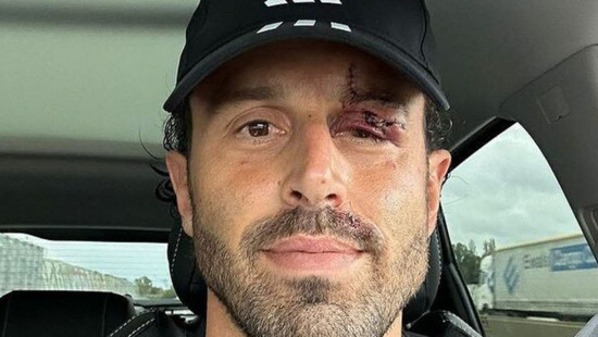 OM-OL : Fabio Grosso auditionné ce jeudi, la LFP doit se prononcer sur le match