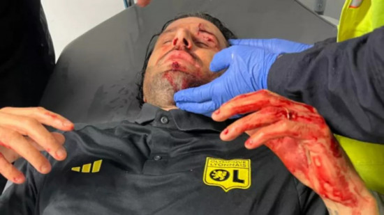 Caillassage du bus de l’OL à Marseille : l'enquête classée sans suite Caillassage du bus de l’OL à Marseille : l'enquête classée sans suite