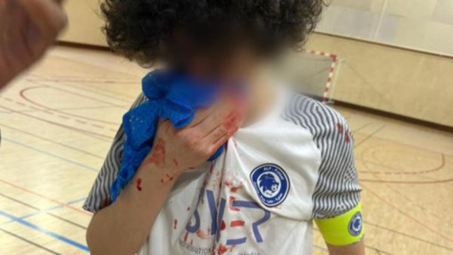 Un match de futsal U18 vire &agrave; la bagarre g&eacute;n&eacute;rale &agrave; Rillieux-la-Pape : un club retire toutes ses &eacute;quipes des championnats